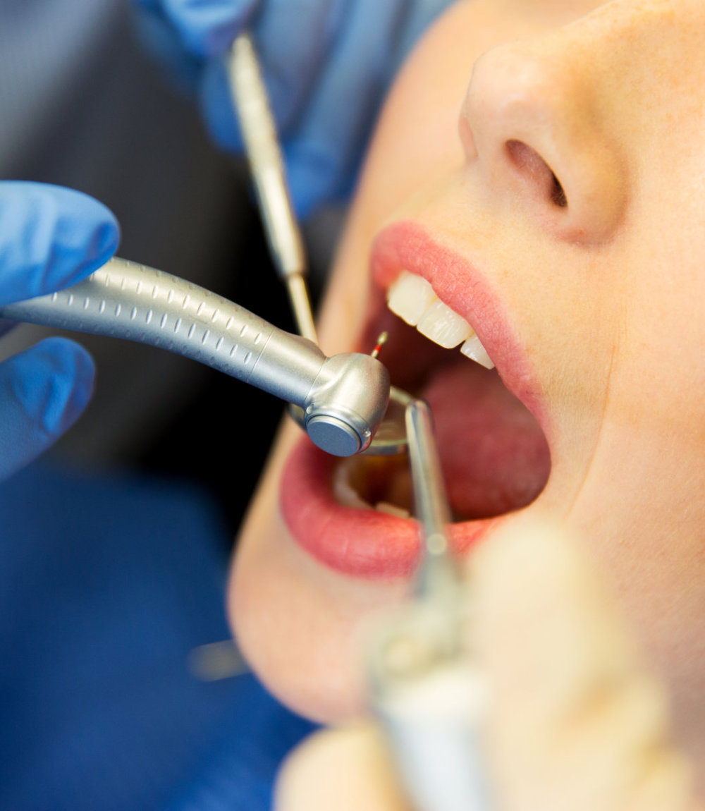 Top 9 Tips With dental cleaning fees