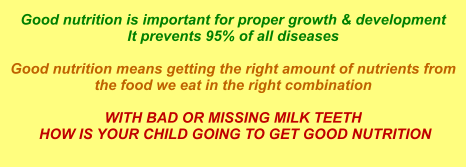 Good nutrition is important for proper growth & development It prevents 95% of all diseases  Good nutrition means getting the right amount of nutrients from the food we eat in the right combination  WITH BAD OR MISSING MILK TEETH  HOW IS YOUR CHILD GOING TO GET GOOD NUTRITION